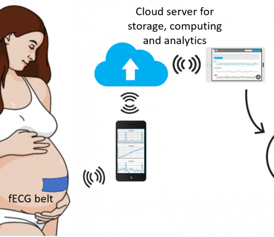Hệ thống IOT theo dõi điện tim thai nhi với cảm biến không tiếp xúc